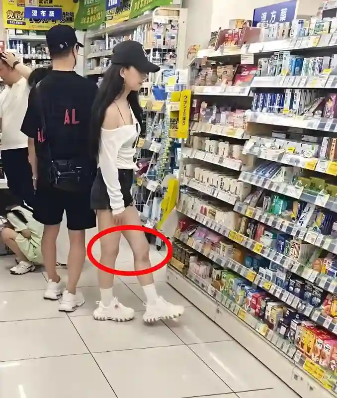 汪峰女友森林北近照曝光，膝盖上淤青明显，在日本药店买药引热议