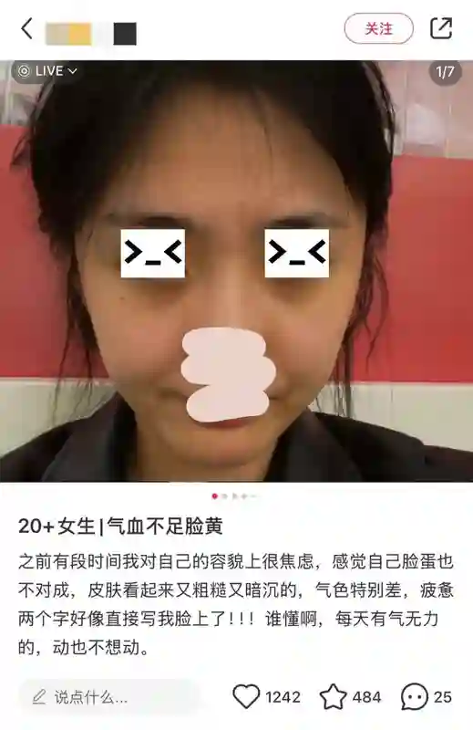 表面陪谢霆锋度假，实则去日本打50万一支水光针？王菲真是林允唯一的姐…