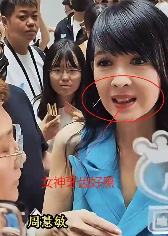 57岁周慧敏现身，牙齿又黄又黑太真实，满脸皱纹女神形象不复