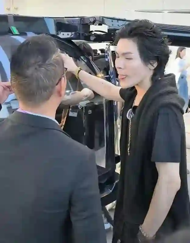 向佐似乎整容失败，根本没眼看，郭碧婷血亏，这根本不是钱的事!