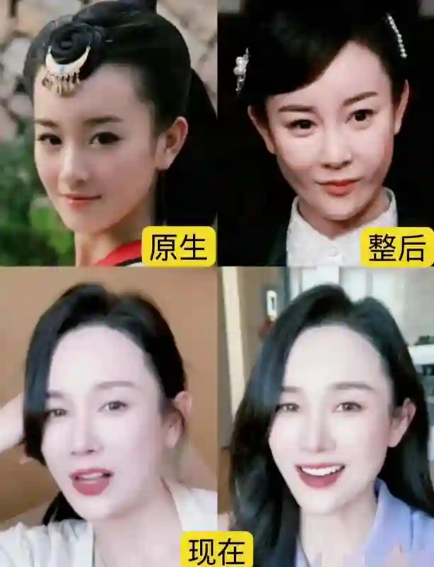看到张檬娄艺潇戚薇沦落到无戏可拍才懂章子怡为何不追逐医美逆龄