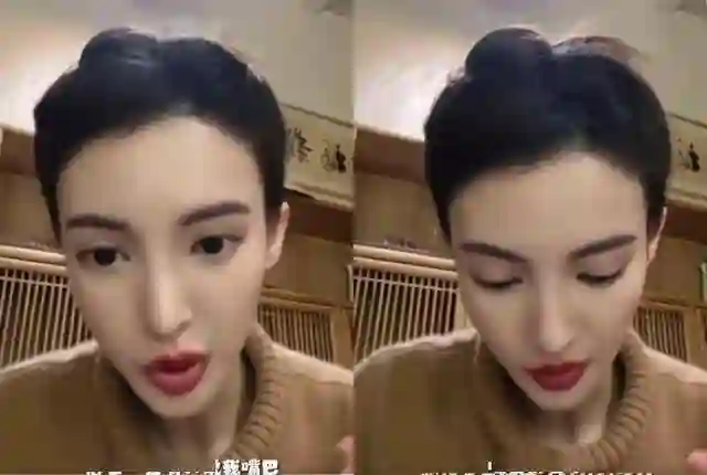 情史混乱、整容上瘾，这一次，谁都救不了鼻歪嘴斜的资源咖金晨！