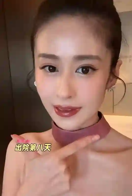 颖儿出院8天复工，穿抹胸裙瘦成“皮包骨”，术后痛到不敢躺下