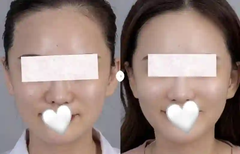 黄圣依熹妃回宫！拿了大笔财产后，新脸回春成章泽天+刘亦菲结合体？