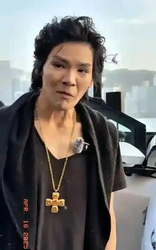向佐似乎整容失败，根本没眼看，郭碧婷血亏，这根本不是钱的事!