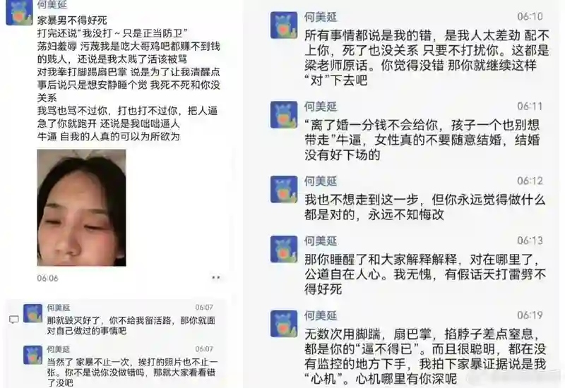 何美延公开指控老公家暴细节称掐脖子险致窒息