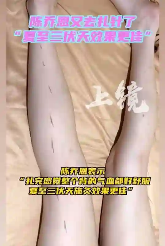 陈乔恩分享夏至养生实录：赶在三伏天扎针施灸，直呼 
