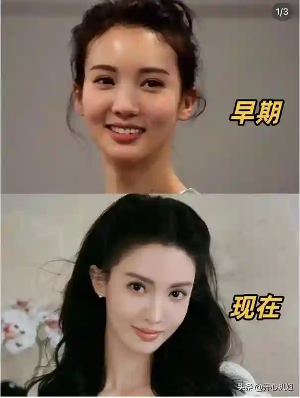 金晨的脸好吓人，鼻子歪了，嘴也歪了，动脸后遗症太可怕，脸僵了