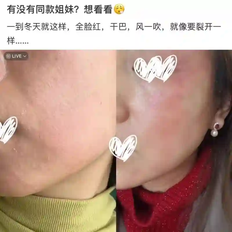 表面陪谢霆锋度假，实则去日本打50万一支水光针？王菲真是林允唯一的姐…