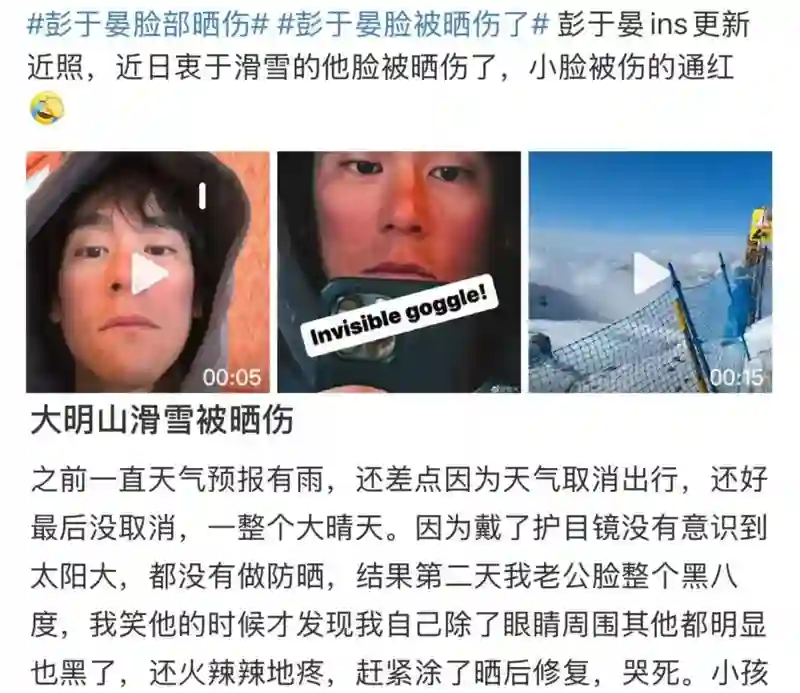 表面陪谢霆锋度假，实则去日本打50万一支水光针？王菲真是林允唯一的姐…