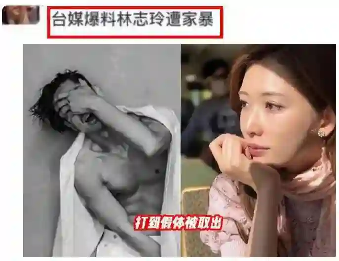 6年变迁！林志玲远嫁日本后受伤退缩，网友猜疑被虐