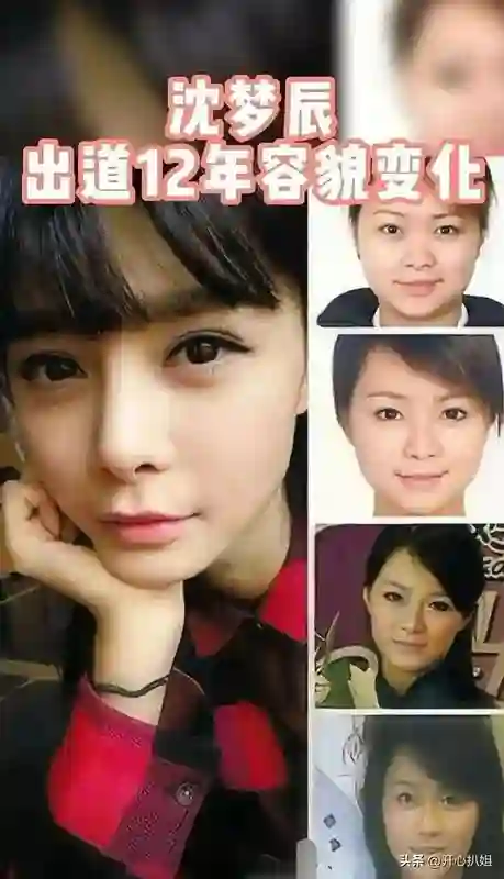 金晨的脸好吓人，鼻子歪了，嘴也歪了，动脸后遗症太可怕，脸僵了