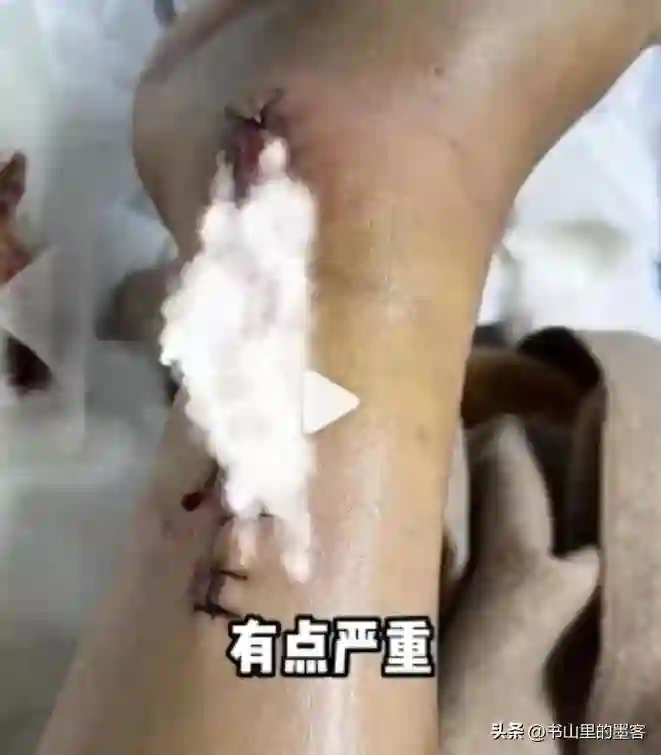 演员陈学冬：两年4次手术，11部作品被下架，如今生活无法自理