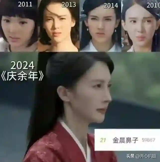 金晨的脸好吓人，鼻子歪了，嘴也歪了，动脸后遗症太可怕，脸僵了