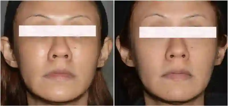 黄圣依熹妃回宫！拿了大笔财产后，新脸回春成章泽天+刘亦菲结合体？