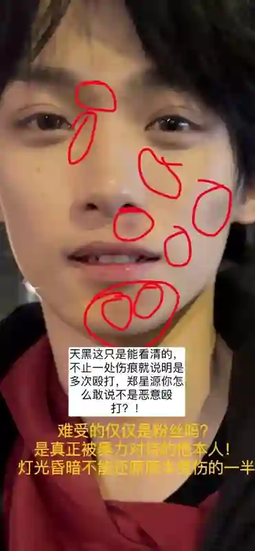 一个月前，任谁都想不到他会塌房？