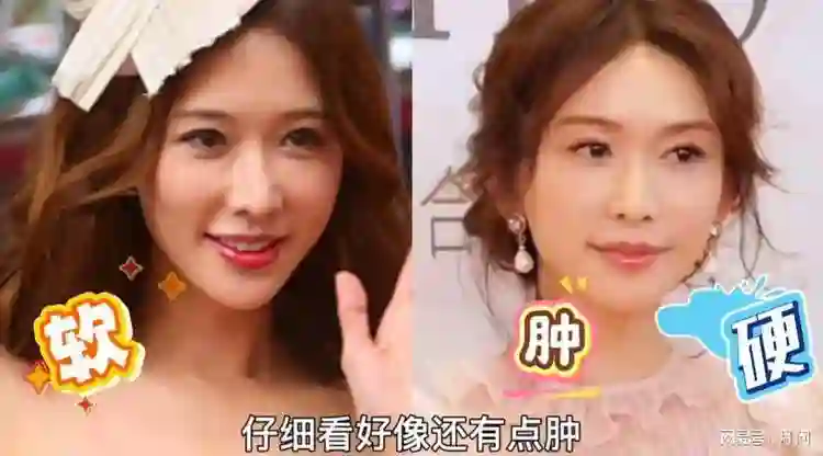 do不do脸能有多大差别？孙俪杨紫林志玲罕见同框一目了然