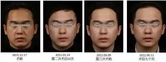 黄圣依熹妃回宫！拿了大笔财产后，新脸回春成章泽天+刘亦菲结合体？