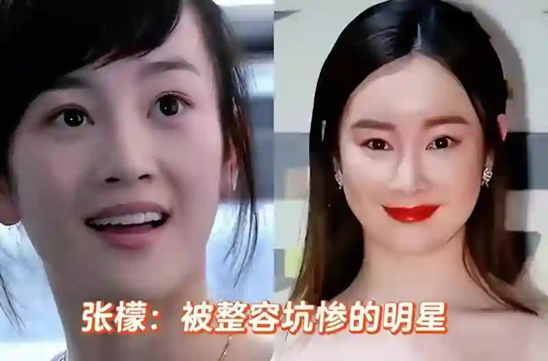 看到张檬娄艺潇戚薇沦落到无戏可拍才懂章子怡为何不追逐医美逆龄