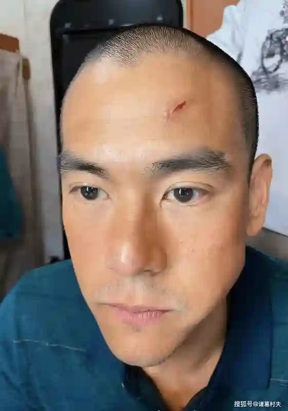 明星明星卸妆后，真人卤蛋忍了、周冬雨大黄牙忍了、萧亚轩鞋拔子脸没忍住