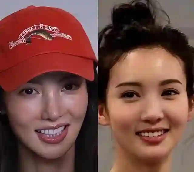 情史混乱、整容上瘾，这一次，谁都救不了鼻歪嘴斜的资源咖金晨！