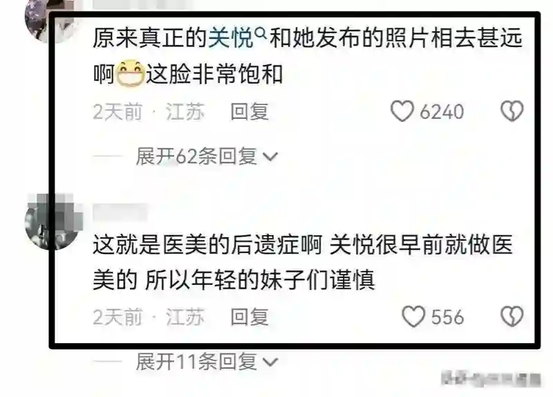 关悦变样，脸部略肿，法令纹显现，网友：自然衰老也不错