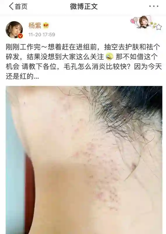 杨紫又翻车了，私下路透照片脸部僵硬垮脸老态，网友直呼撞脸蔡明