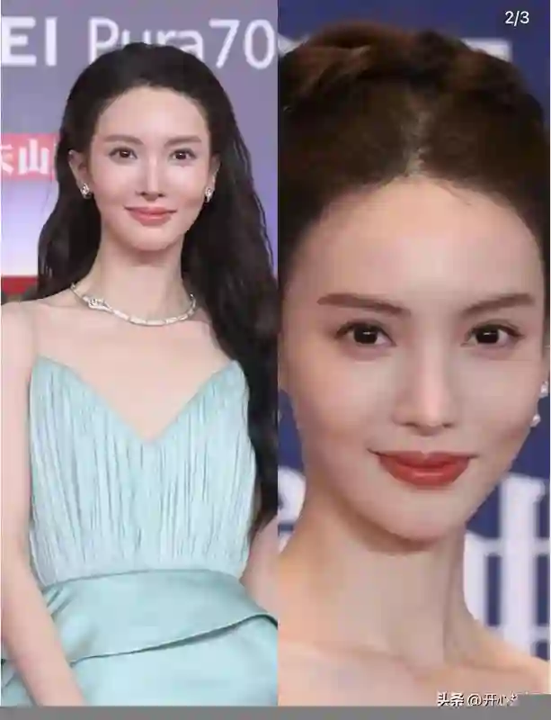 金晨的脸好吓人，鼻子歪了，嘴也歪了，动脸后遗症太可怕，脸僵了