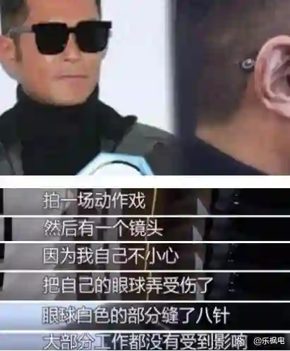 54岁古天乐再动手术，每日吃一顿饭，面相苍老被指不如70岁吕良伟