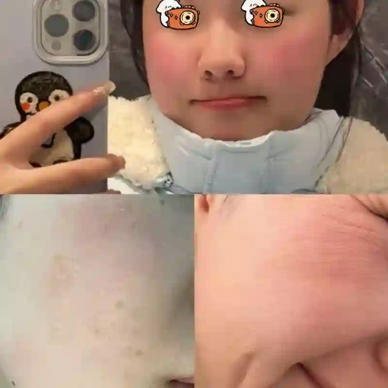 表面陪谢霆锋度假，实则去日本打50万一支水光针？王菲真是林允唯一的姐…