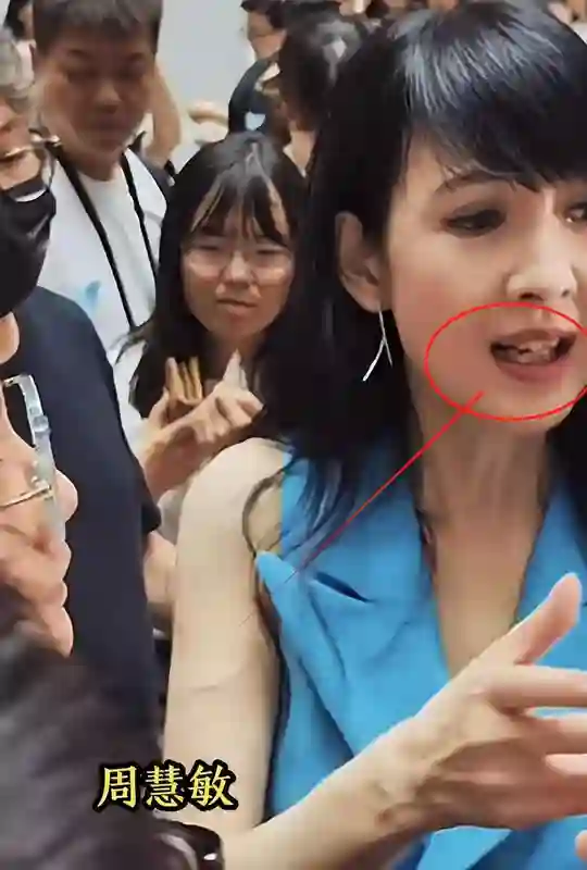 57岁周慧敏现身，牙齿又黄又黑太真实，满脸皱纹女神形象不复