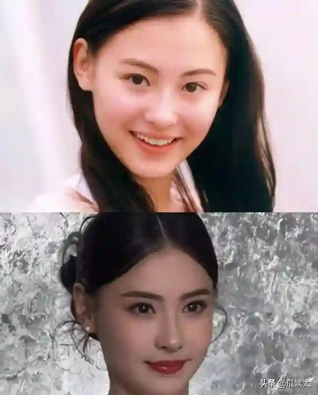 很多人心中的香港第一美女张柏芝，如今竟然也选择了医美这条路