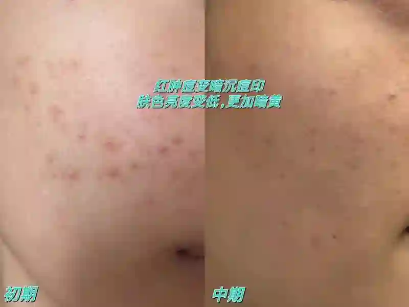 表面陪谢霆锋度假，实则去日本打50万一支水光针？王菲真是林允唯一的姐…